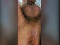 Michel dube ass hole full of worms exposed