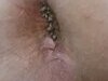 Michel dube full naked with cock and his ass hole full of worms exposed