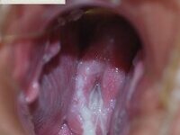 HFV Webslut (France) #01