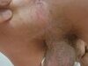 Michel dube cock and ass hole full of worms exposed